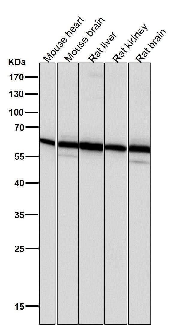 Anti-PMP70 ABCD3 Monoclonal Antibody Boster Bio