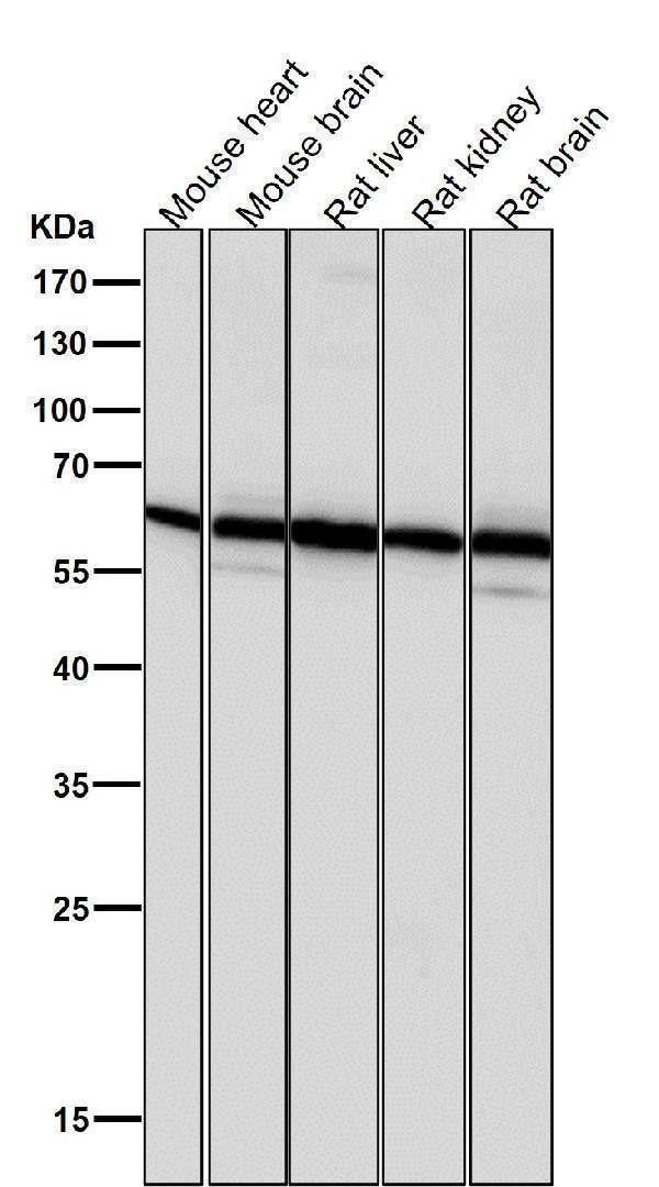 Anti-PMP70 ABCD3 Monoclonal Antibody Boster Bio