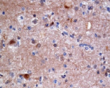 Anti-ATP citrate lyase ACLY Rabbit Monoclonal Antibody Boster Bio