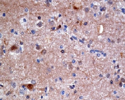 Anti-ATP citrate lyase ACLY Rabbit Monoclonal Antibody Boster Bio