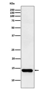 Anti-FABPI Rabbit Monoclonal Antibody Boster Bio