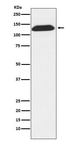 Anti-DNA Ligase I Rabbit Monoclonal Antibody Boster Bio