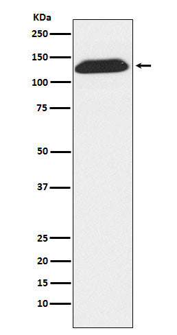 Anti-DNA Ligase I Rabbit Monoclonal Antibody Boster Bio