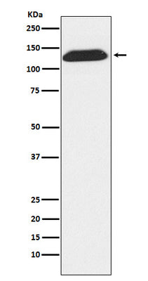 Anti-DNA Ligase I Rabbit Monoclonal Antibody Boster Bio