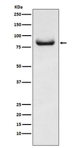 Anti-APPL Rabbit Monoclonal Antibody Boster Bio