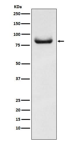 Anti-APPL Rabbit Monoclonal Antibody Boster Bio