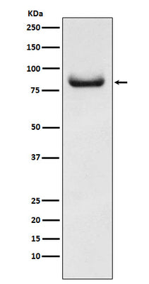 Anti-APPL Rabbit Monoclonal Antibody Boster Bio