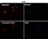 Anti-PFKFB3 Monoclonal Antibody Boster Bio