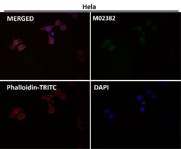 Anti-PFKFB3 Monoclonal Antibody Boster Bio