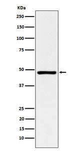 Anti-ACADM Rabbit Monoclonal Antibody Boster Bio