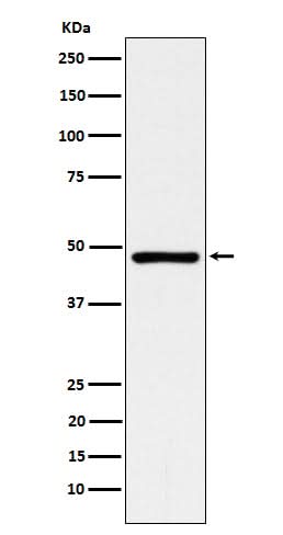 Anti-ACADM Rabbit Monoclonal Antibody Boster Bio
