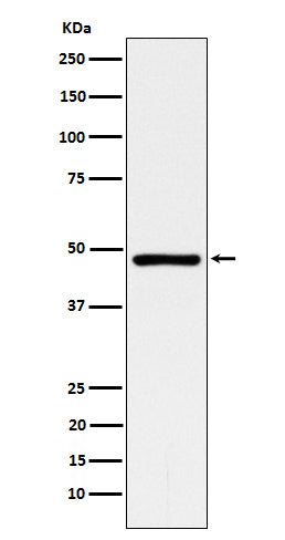 Anti-ACADM Rabbit Monoclonal Antibody Boster Bio