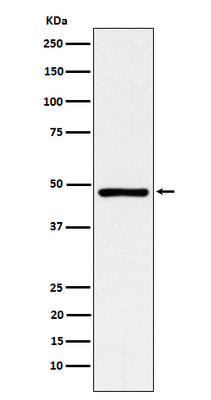 Anti-ACADM Rabbit Monoclonal Antibody Boster Bio