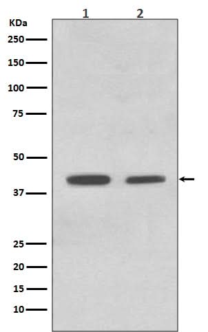 Anti-ACADM/Mcad Rabbit Monoclonal Antibody Boster Bio