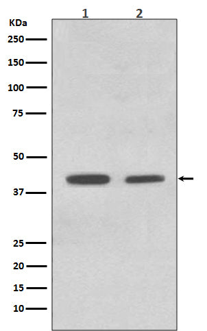 Anti-ACADM/Mcad Rabbit Monoclonal Antibody Boster Bio
