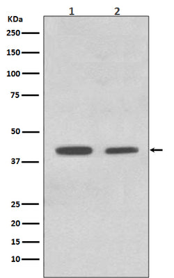 Anti-ACADM/Mcad Rabbit Monoclonal Antibody Boster Bio