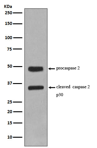 Anti-Caspase-2 CASP2 Rabbit Monoclonal Antibody Boster Bio