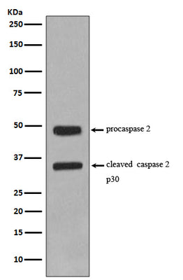 Anti-Caspase-2 CASP2 Rabbit Monoclonal Antibody Boster Bio