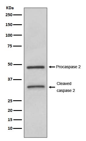 Anti-Caspase-2 CASP2 Rabbit Monoclonal Antibody Boster Bio
