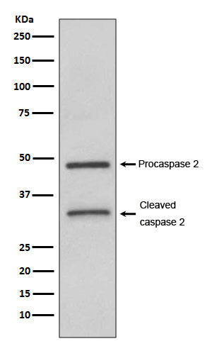 Anti-Caspase-2 CASP2 Rabbit Monoclonal Antibody Boster Bio