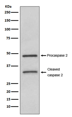 Anti-Caspase-2 CASP2 Rabbit Monoclonal Antibody Boster Bio