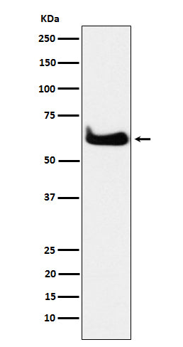 Anti-TCP1 alpha Rabbit Monoclonal Antibody Boster Bio