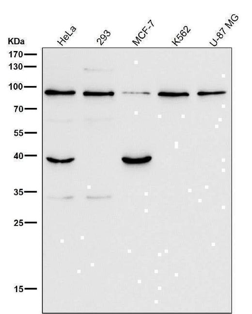Anti-GRP94 HSP90B1 Rabbit Monoclonal Antibody Boster Bio