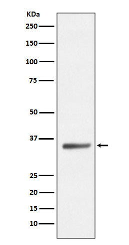 Anti-SIRT5/Sirtuin 5 Rabbit Monoclonal Antibody Boster Bio