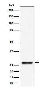 Anti-SBDS Rabbit Monoclonal Antibody Boster Bio