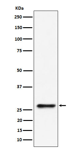 Anti-SBDS Rabbit Monoclonal Antibody Boster Bio
