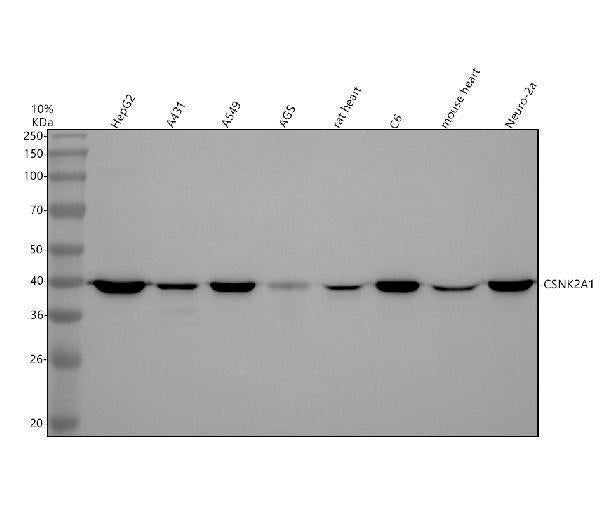 Anti-CKII alpha CSNK2A1 Rabbit Monoclonal Antibody Boster Bio