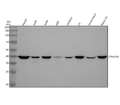Anti-CKII alpha CSNK2A1 Rabbit Monoclonal Antibody Boster Bio