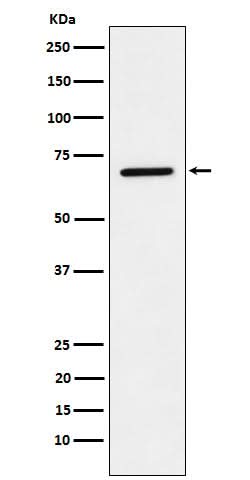 Anti-LTA4H Rabbit Monoclonal Antibody Boster Bio