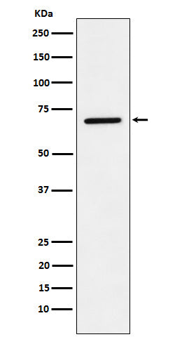 Anti-LTA4H Rabbit Monoclonal Antibody Boster Bio