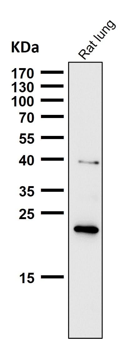 Anti-Ferritin Heavy Chain Rabbit Monoclonal Antibody Boster Bio
