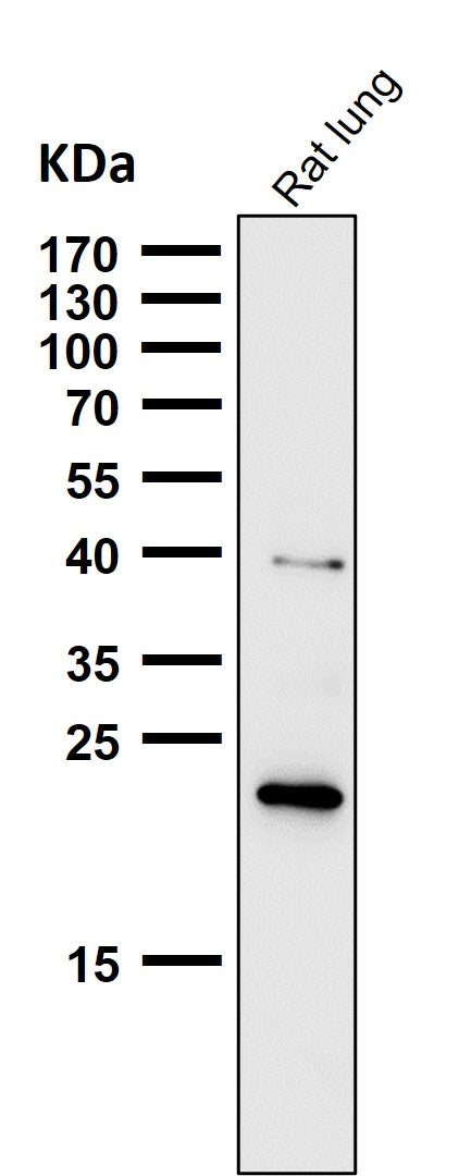 Anti-Ferritin Heavy Chain Rabbit Monoclonal Antibody Boster Bio