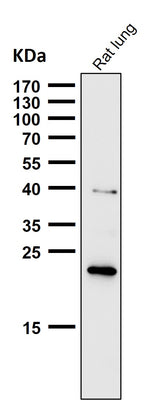 Anti-Ferritin Heavy Chain Rabbit Monoclonal Antibody Boster Bio
