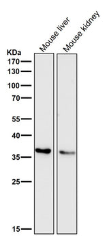 Anti-IGFBP7 Monoclonal Antibody Boster Bio