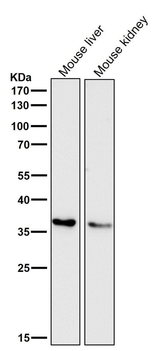 Anti-IGFBP7 Monoclonal Antibody Boster Bio
