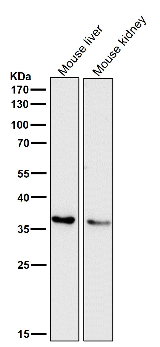 Anti-IGFBP7 Monoclonal Antibody Boster Bio