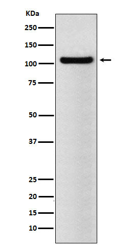 Anti-BRD2 Rabbit Monoclonal Antibody Boster Bio