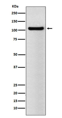 Anti-BRD2 Rabbit Monoclonal Antibody Boster Bio