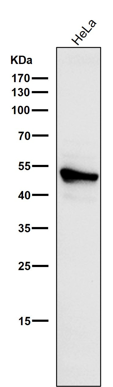 Anti-Cytokeratin 7 KRT7 Rabbit Monoclonal Antibody Boster Bio