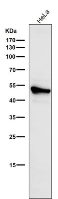 Anti-Cytokeratin 7 KRT7 Rabbit Monoclonal Antibody Boster Bio
