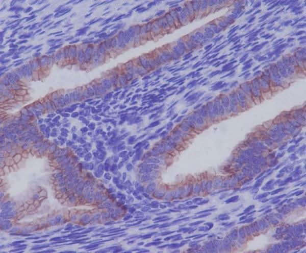 Anti-Cytokeratin 7 KRT7 Rabbit Monoclonal Antibody Boster Bio