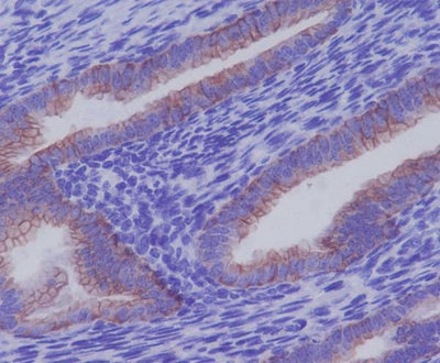 Anti-Cytokeratin 7 KRT7 Rabbit Monoclonal Antibody Boster Bio