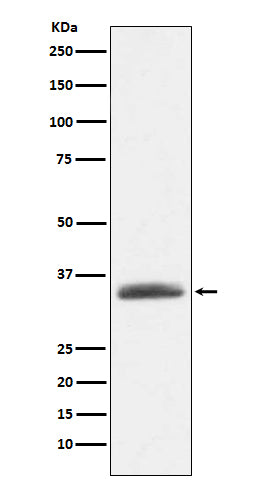 Anti-AMBP Rabbit Monoclonal Antibody Boster Bio