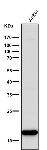 Anti-CD3 zeta CD247 Rabbit Monoclonal Antibody Boster Bio