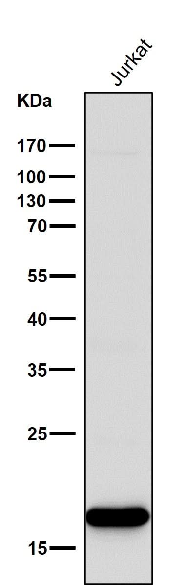 Anti-CD3 zeta CD247 Rabbit Monoclonal Antibody Boster Bio