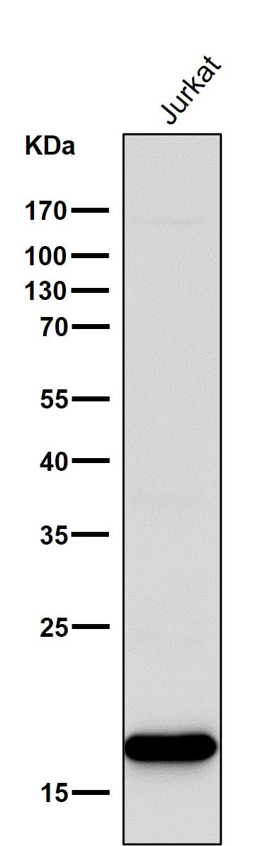Anti-CD3 zeta CD247 Rabbit Monoclonal Antibody Boster Bio